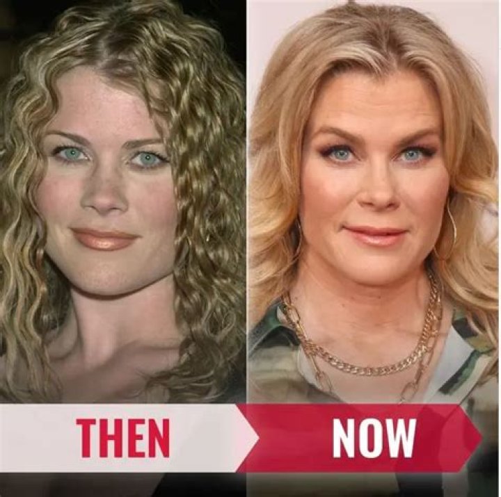 Alison Sweeney Plastic Surgery -Before And After Photos, Fans Suspect Her Facelift!
