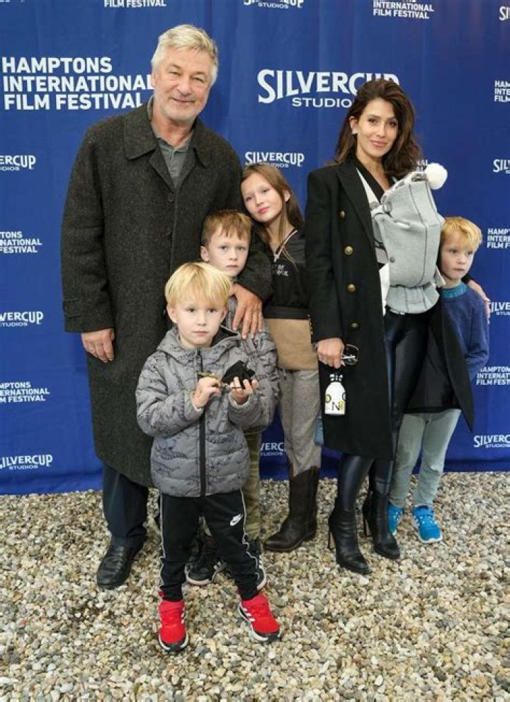 
Hilaria Baldwin Shares Photo of Daughter With Black Eye: ‘You’ll See This Shiner for a While’ 