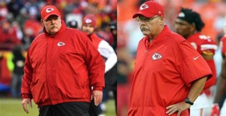 Is Andy Reid Sick? Weight Loss Surgery Rumors Explained