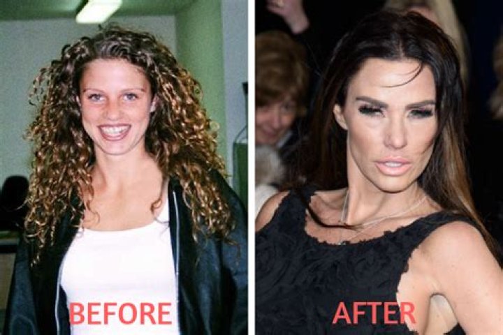 Katie Price Before Plastic Surgery: Did She Get Her Lips And Nose Done?