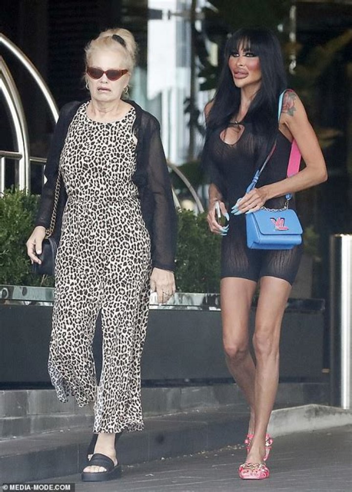 
Tara Jayne Mcconachy Before And After Surgey- Botched Star Sighted In Melbourne 